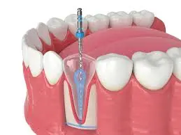DentLink