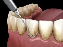 DentLink